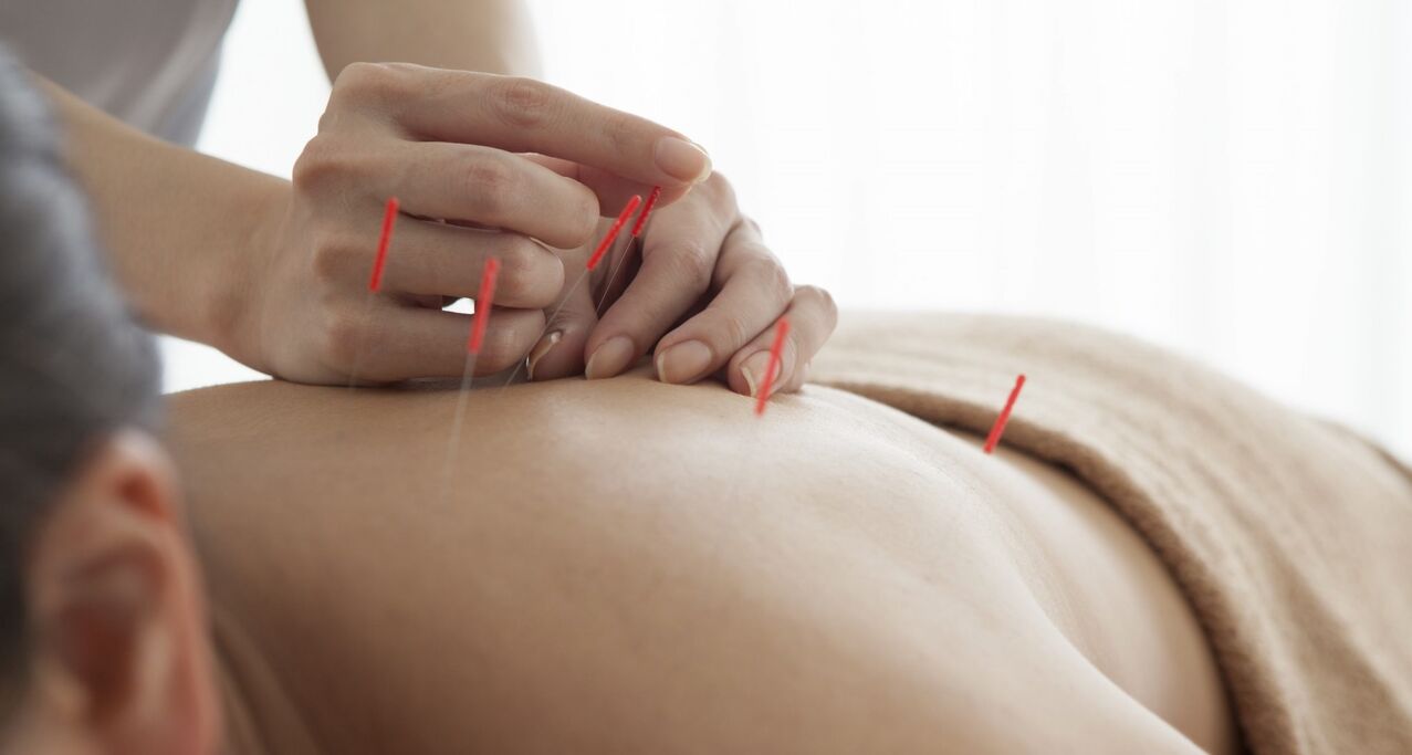 acupunctura pentru a crește potența